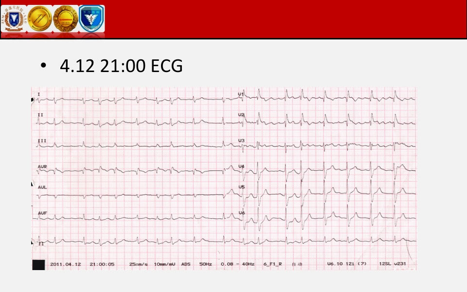 脓毒性心肌病PPT课件下载28