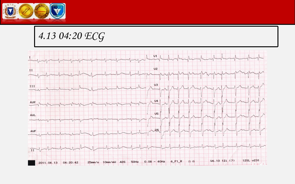 脓毒性心肌病PPT课件下载29