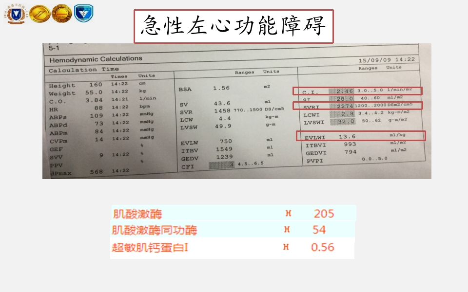 脓毒性心肌病PPT课件下载9