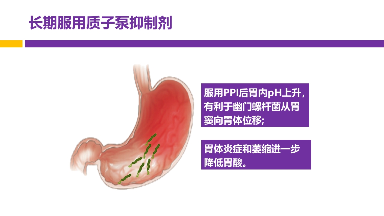 中国第五次幽门螺旋杆菌感染诊治共识解读PPT11