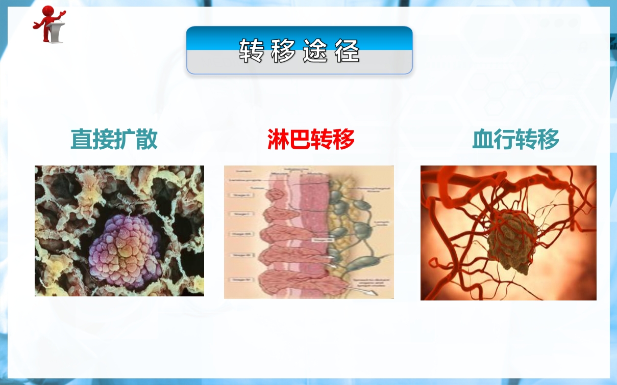 食管癌病人的护理PPT课件下载11