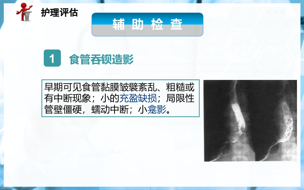 食管癌病人的护理PPT课件下载17