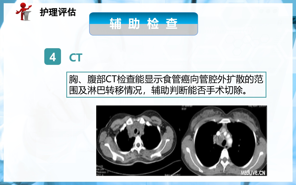 食管癌病人的护理PPT课件下载20