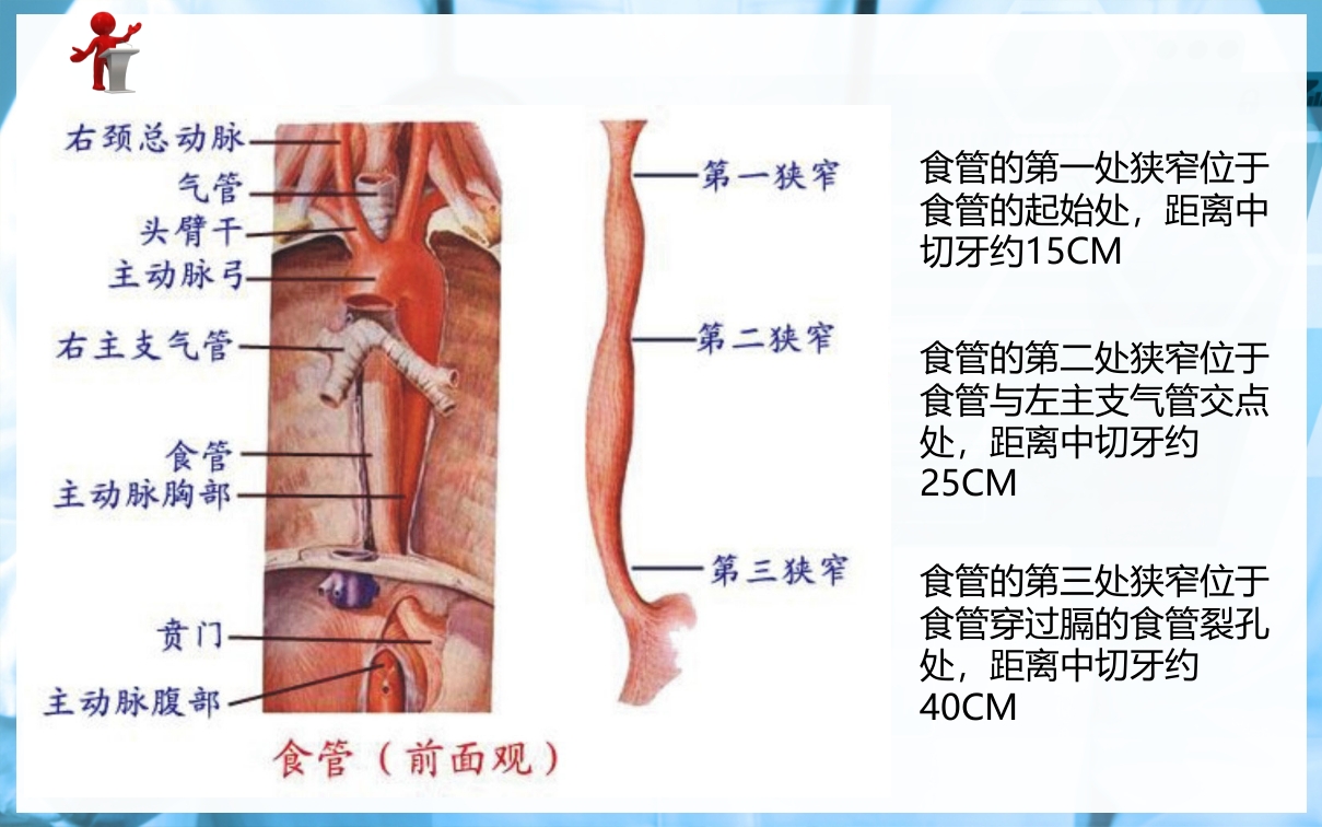 食管癌病人的护理PPT课件下载2