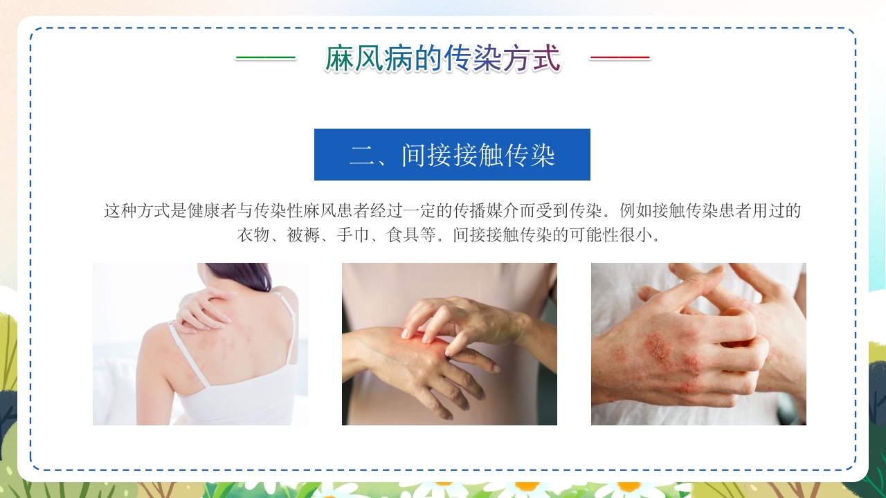 麻风病防治知识传染病预防宣传护理PPT课件11