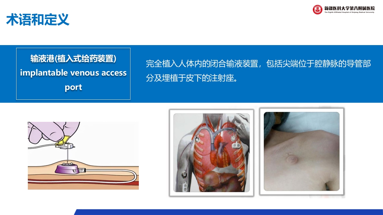 (2023版)静脉治疗护理技术操作标准PPT课件10