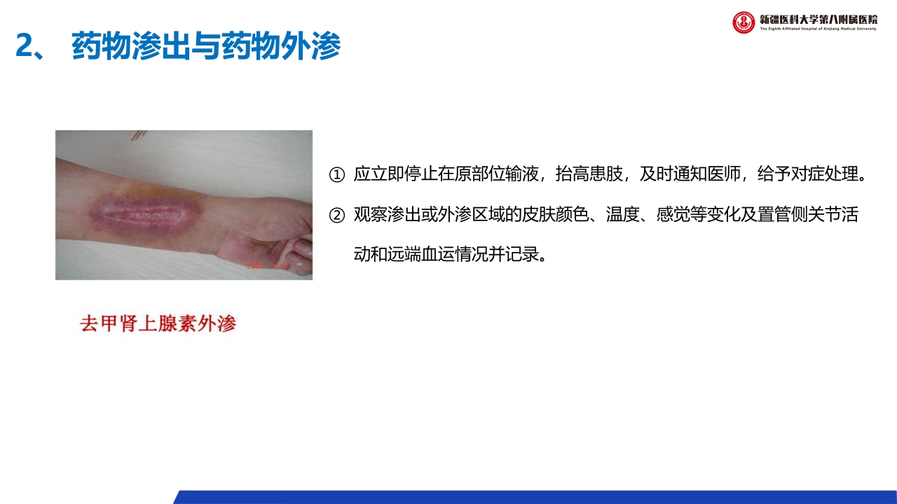 (2023版)静脉治疗护理技术操作标准PPT课件40