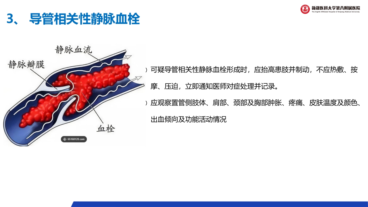 (2023版)静脉治疗护理技术操作标准PPT课件41