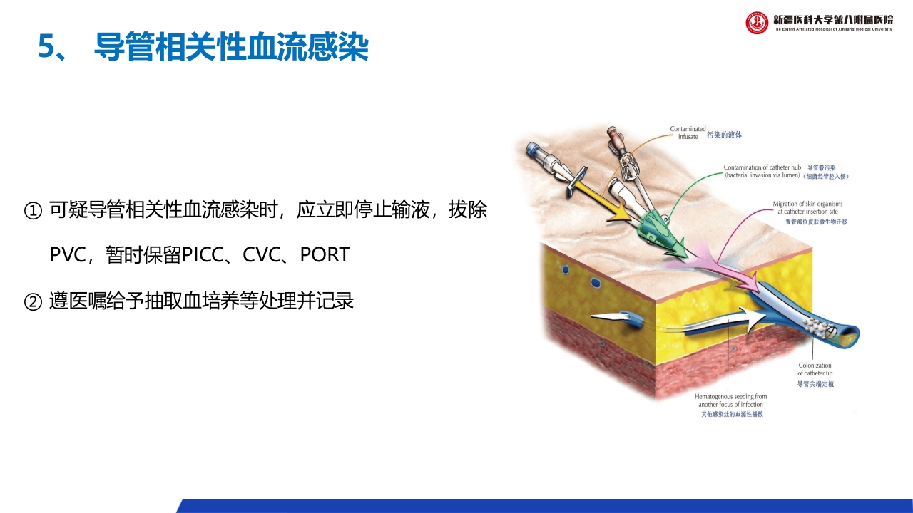 (2023版)静脉治疗护理技术操作标准PPT课件43