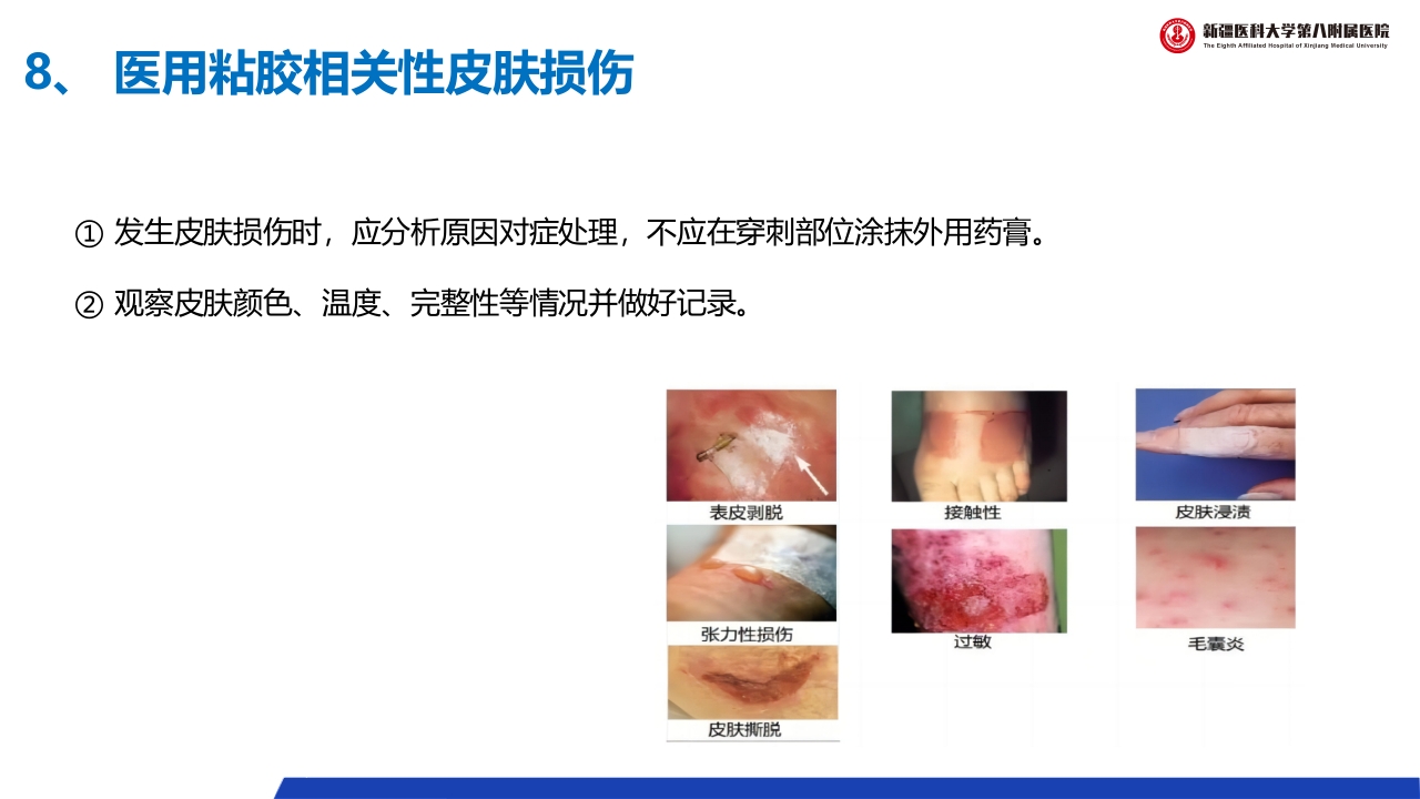 (2023版)静脉治疗护理技术操作标准PPT课件46