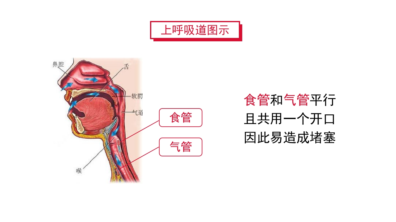 紧急解除气道梗阻瞬间挽救生命海姆里克腹部冲击法PPT课件6