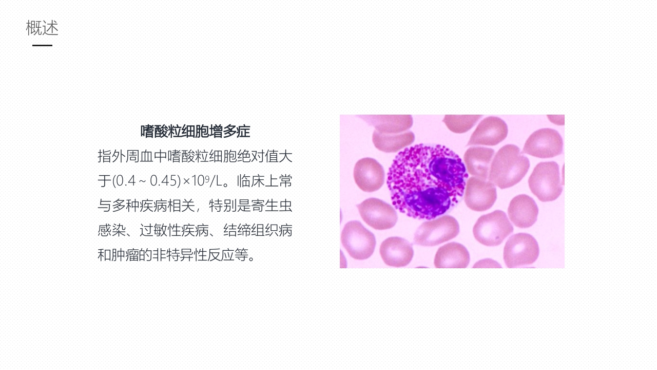 嗜酸性粒细胞增多症护理课件PPT课件4