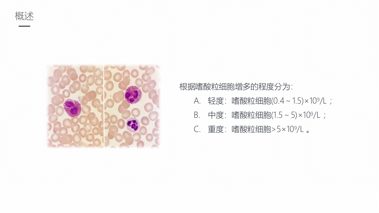 嗜酸性粒细胞增多症护理课件PPT课件5