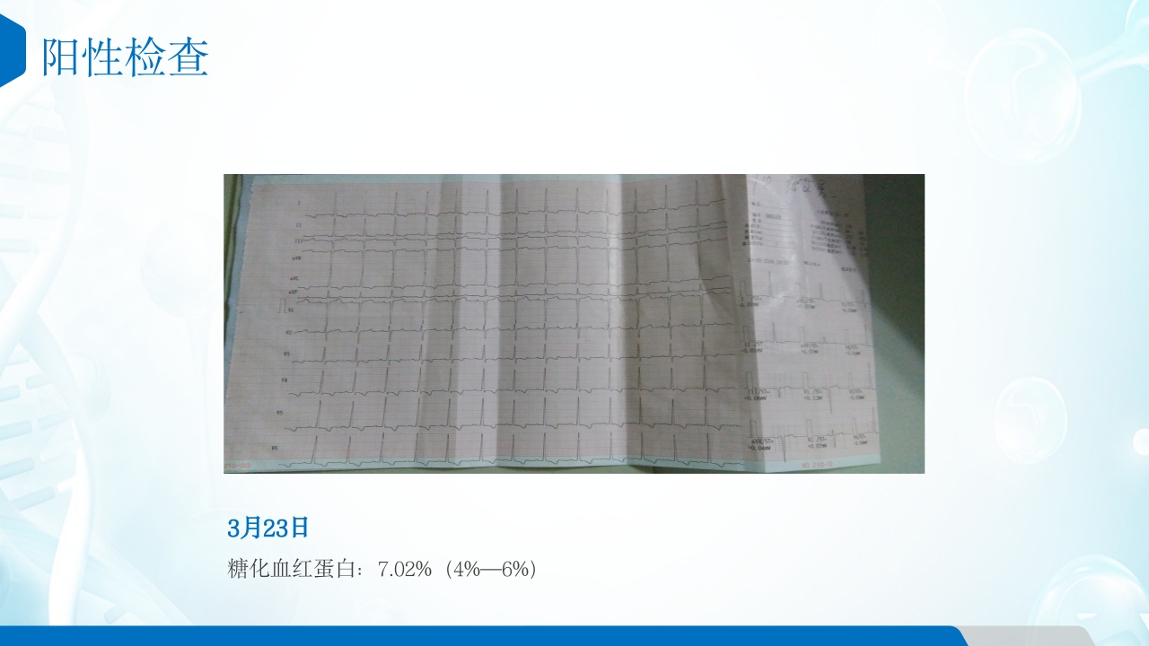 糖尿病患者的护理查房ppt课件8