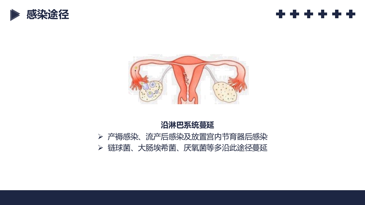 盆腔炎知识介绍PPT课件13
