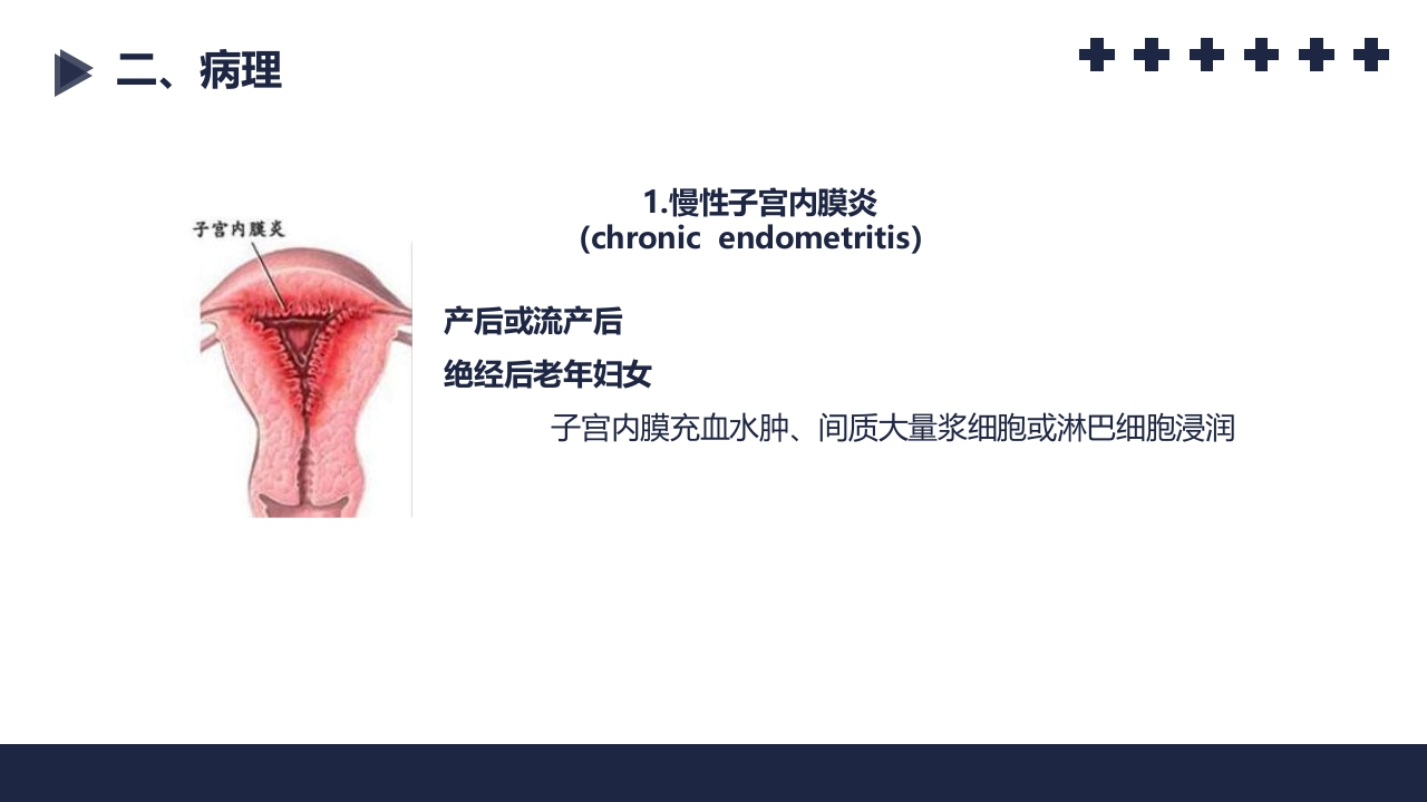 盆腔炎知识介绍PPT课件43