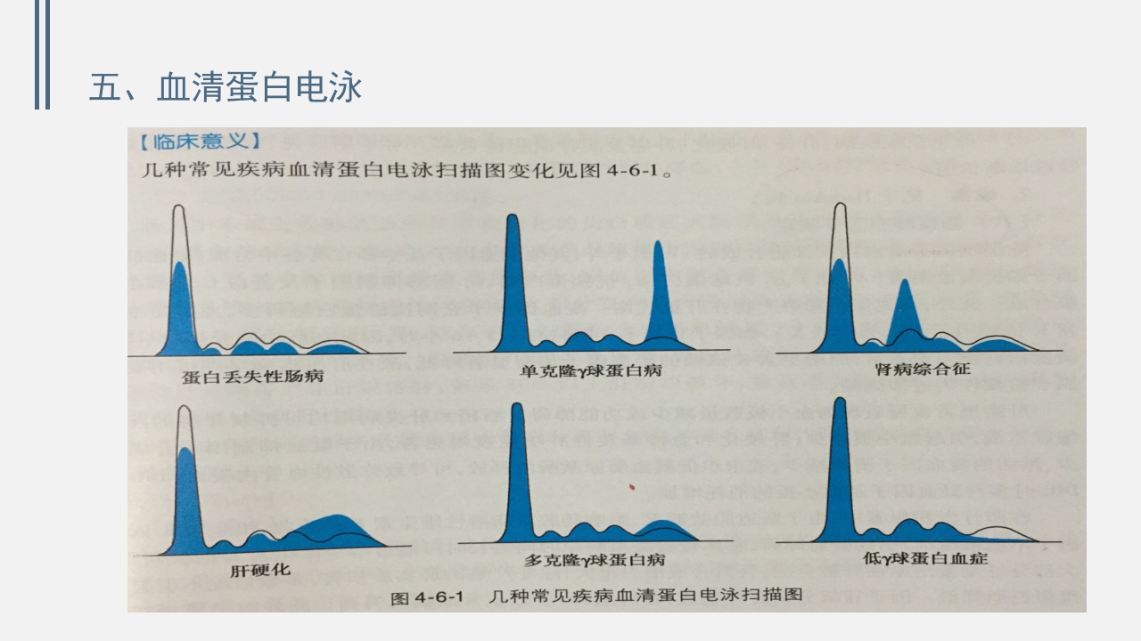 肝功能的实验室检测PPT课件下载28