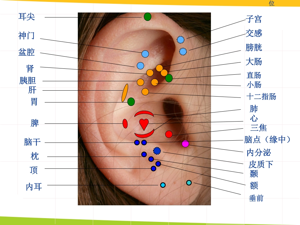 耳穴埋豆与常见病取穴·讲座课件PPT课件20