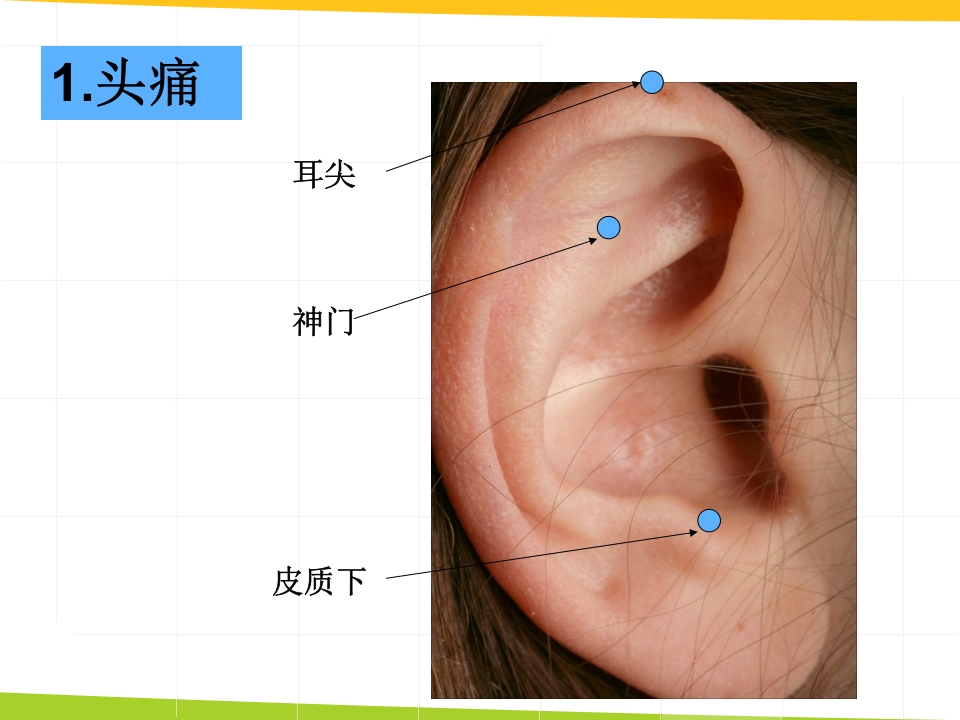 耳穴埋豆与常见病取穴·讲座课件PPT课件22