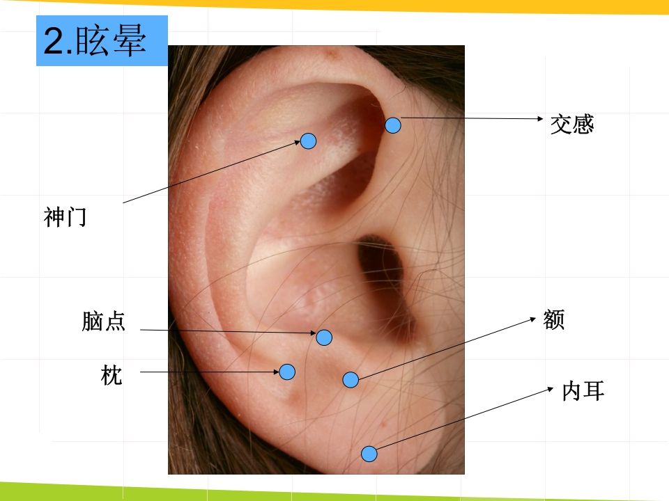 耳穴埋豆与常见病取穴·讲座课件PPT课件24