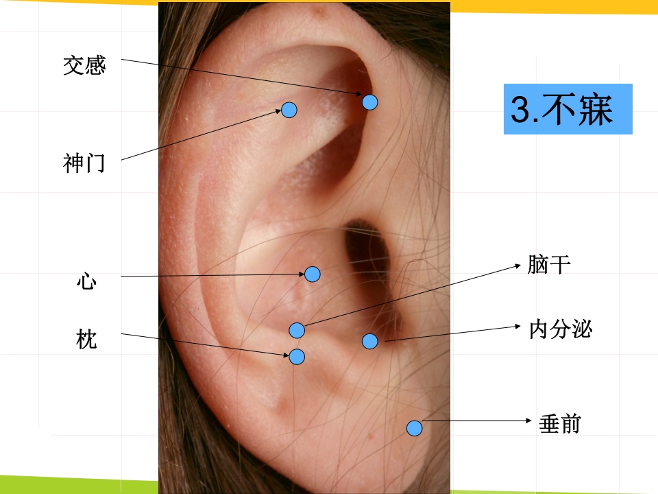 耳穴埋豆与常见病取穴·讲座课件PPT课件26