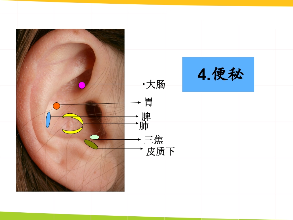 耳穴埋豆与常见病取穴·讲座课件PPT课件28