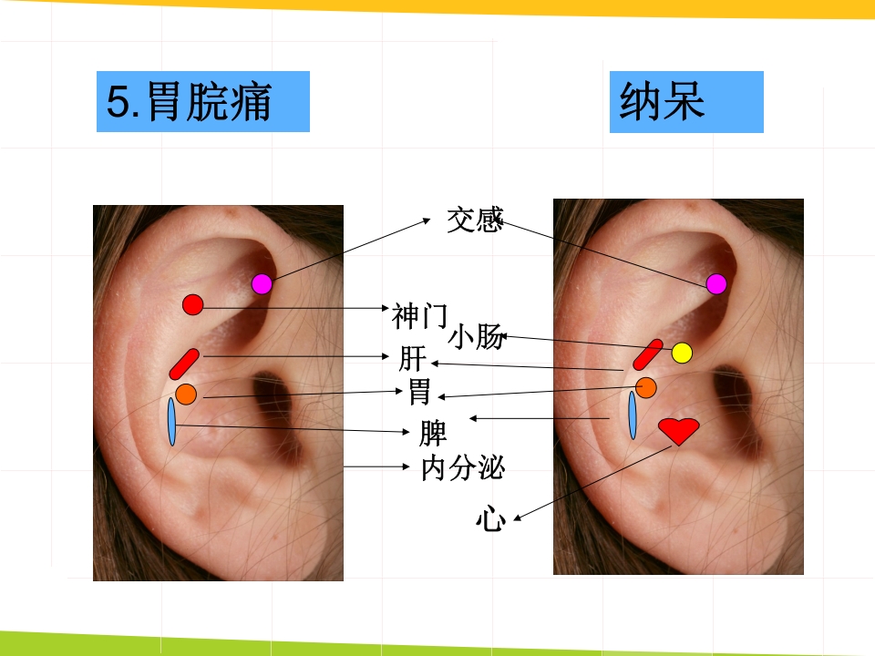 耳穴埋豆与常见病取穴·讲座课件PPT课件30
