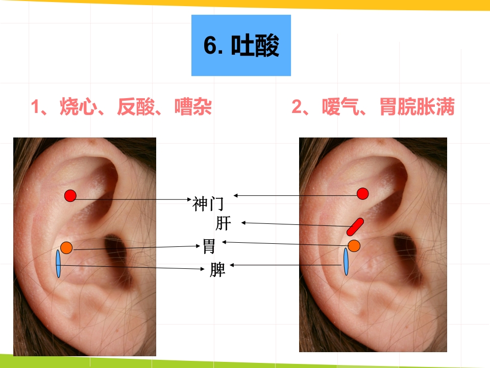 耳穴埋豆与常见病取穴·讲座课件PPT课件31