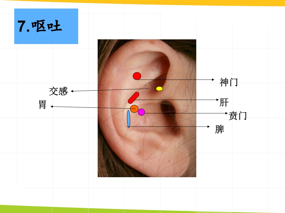 耳穴埋豆与常见病取穴·讲座课件PPT课件32