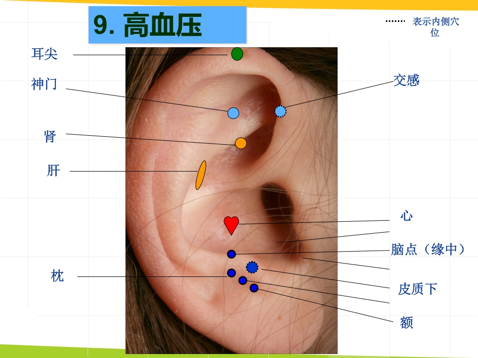 耳穴埋豆与常见病取穴·讲座课件PPT课件36