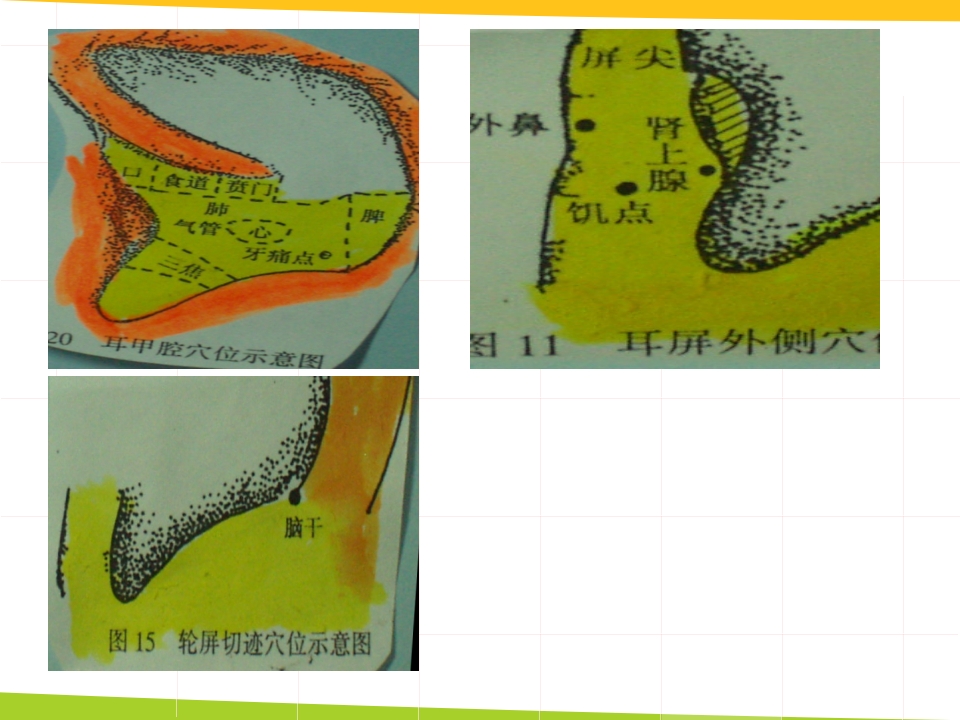 耳穴埋豆与常见病取穴·讲座课件PPT课件38