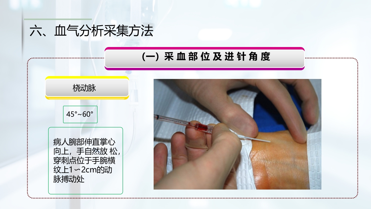 动脉血气的采集与分析PPT课件13