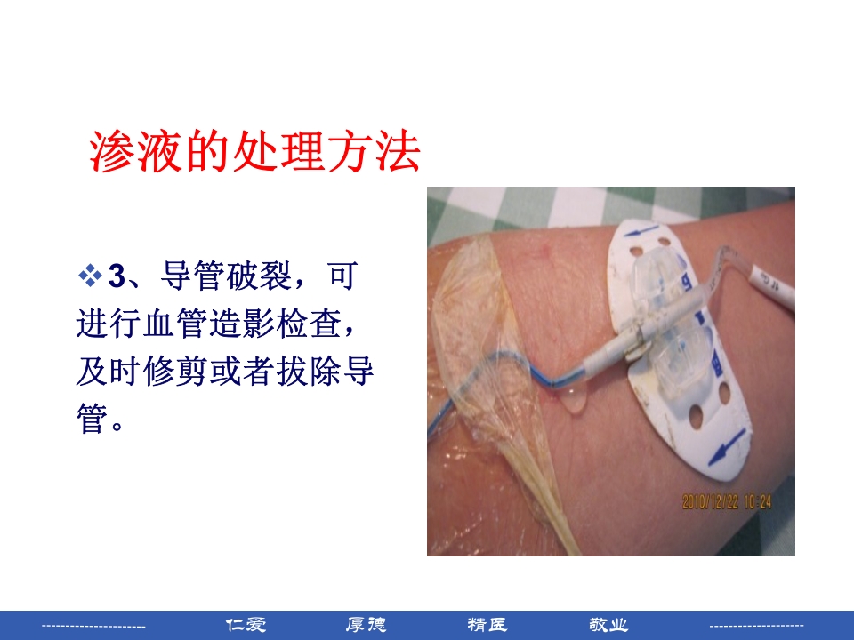 PICC穿刺点渗液与皮肤过敏的处理PPT课件14
