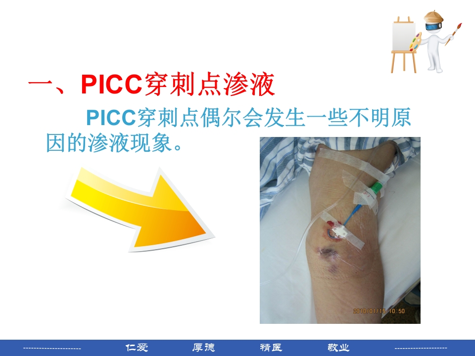 PICC穿刺点渗液与皮肤过敏的处理PPT课件2