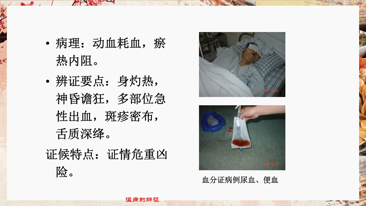 温病学·第四章·温病的辨证PPT课件22