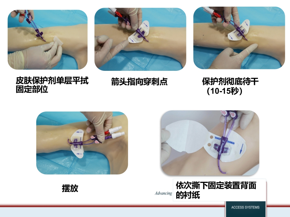 PICC维护标准程序PPT课件28