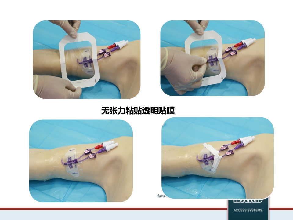 PICC维护标准程序PPT课件30