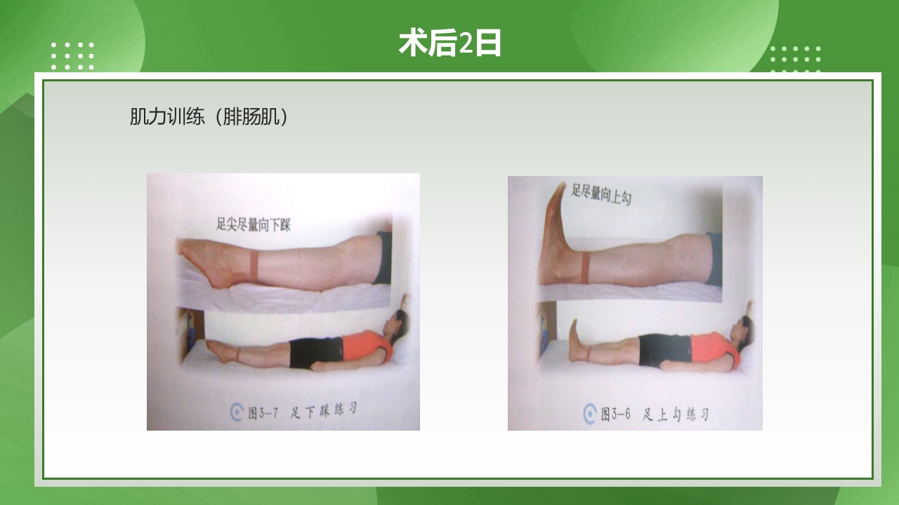 膝关节镜护理查房PPT课件下载33