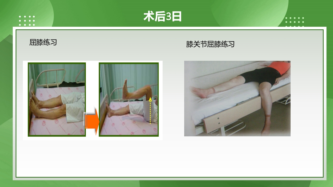 膝关节镜护理查房PPT课件下载37