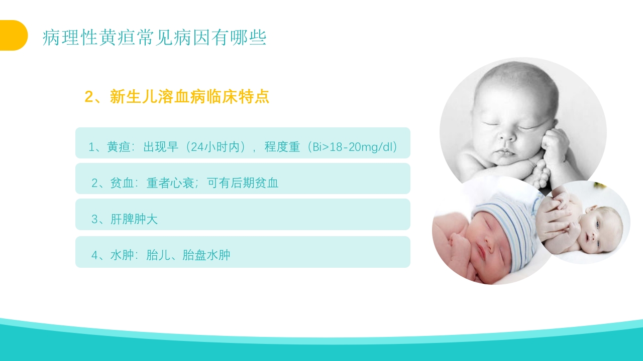 新生儿黄疸治疗护理知识PPT课件13
