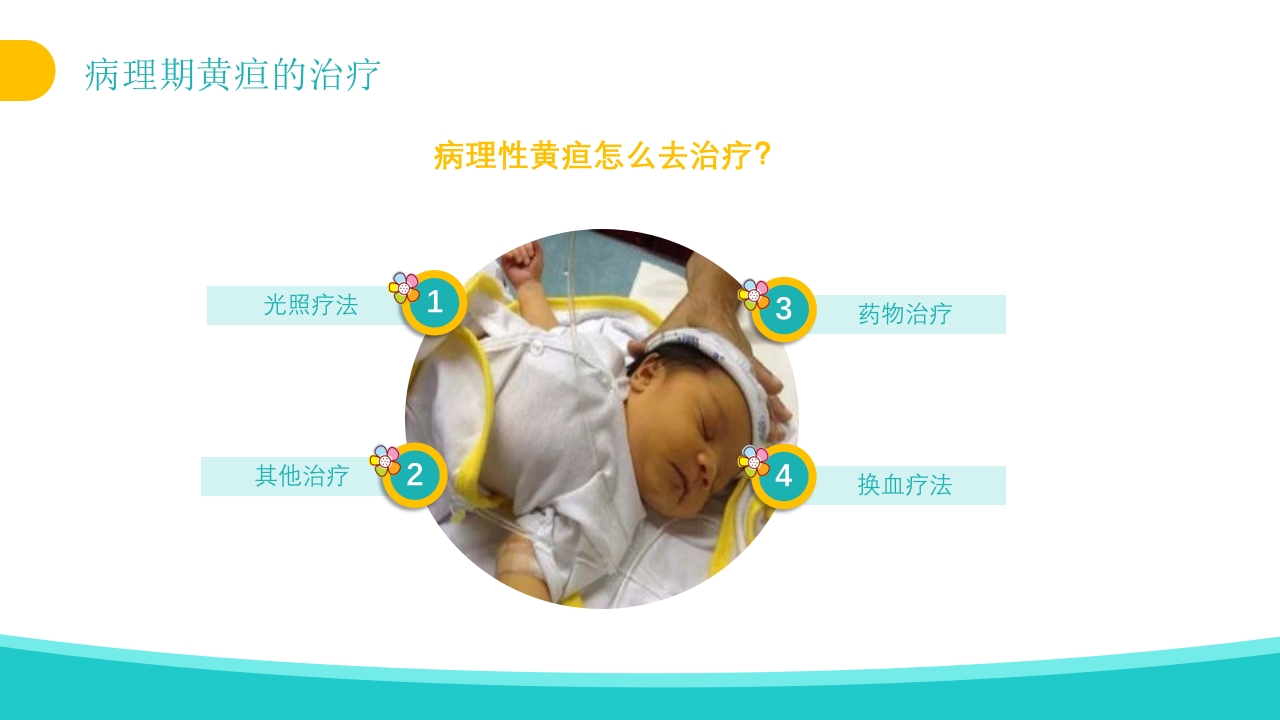 新生儿黄疸治疗护理知识PPT课件25