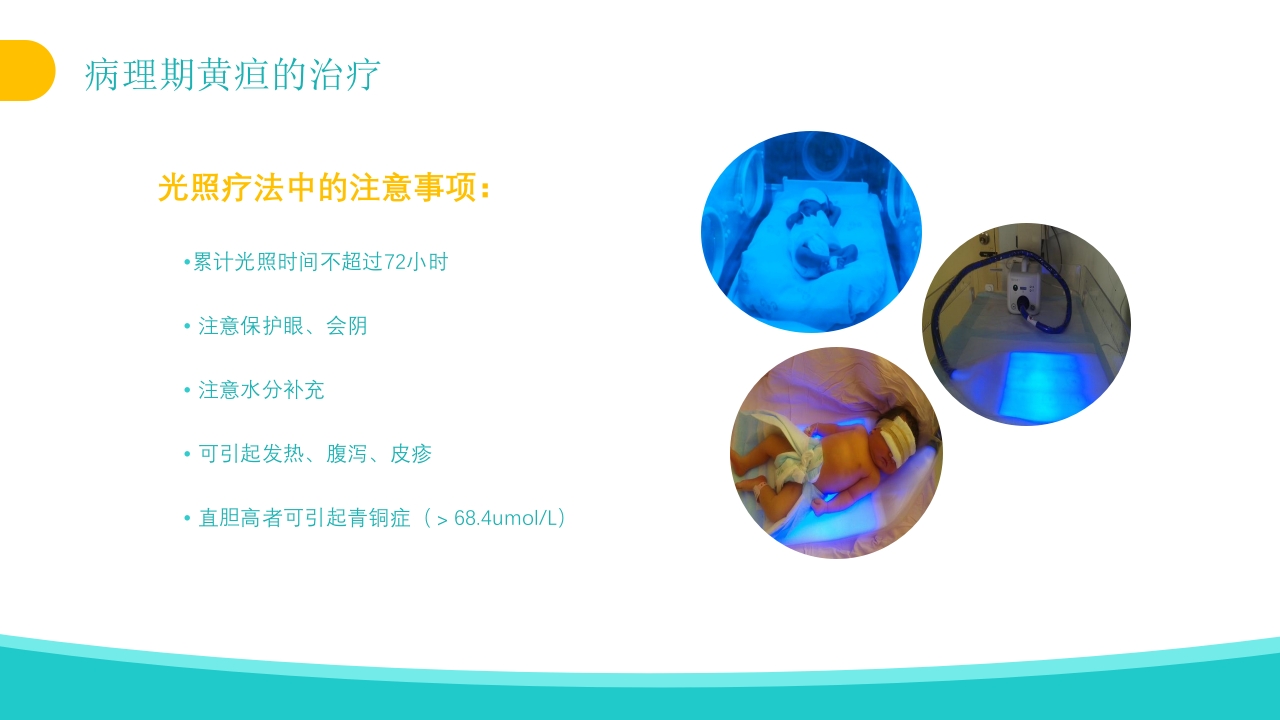 新生儿黄疸治疗护理知识PPT课件29