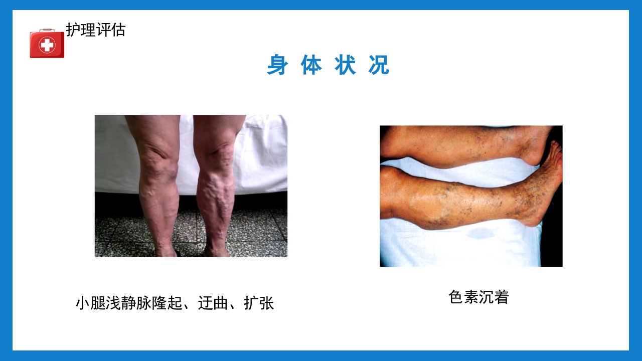 周围血管疾病病人的护理培训PPT课件下载12
