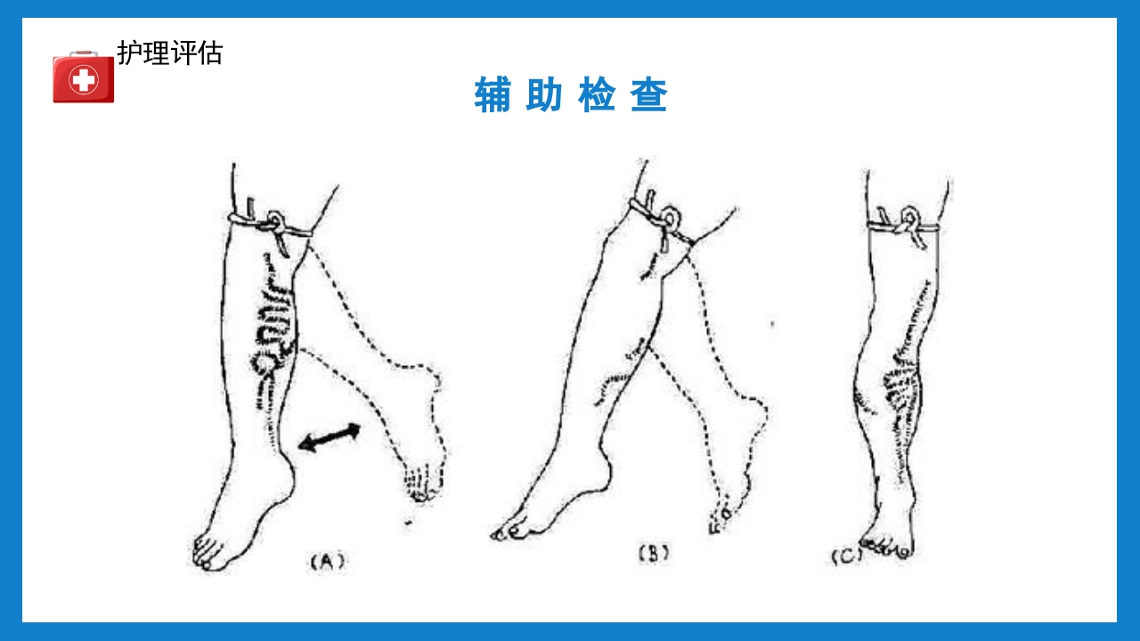 周围血管疾病病人的护理培训PPT课件下载19