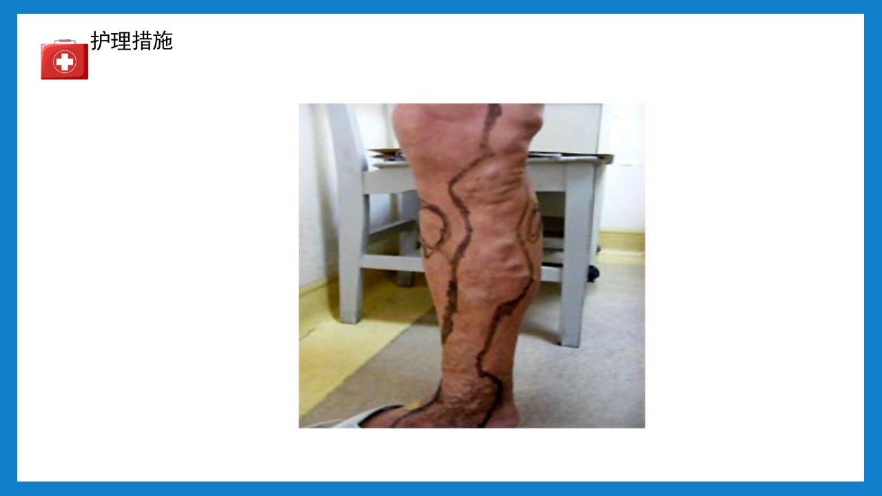 周围血管疾病病人的护理培训PPT课件下载33