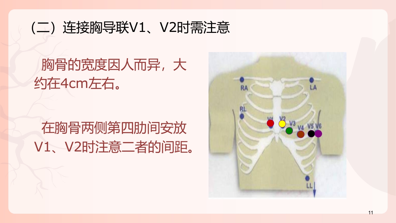 心电图机的正确使用PPT课件下载12