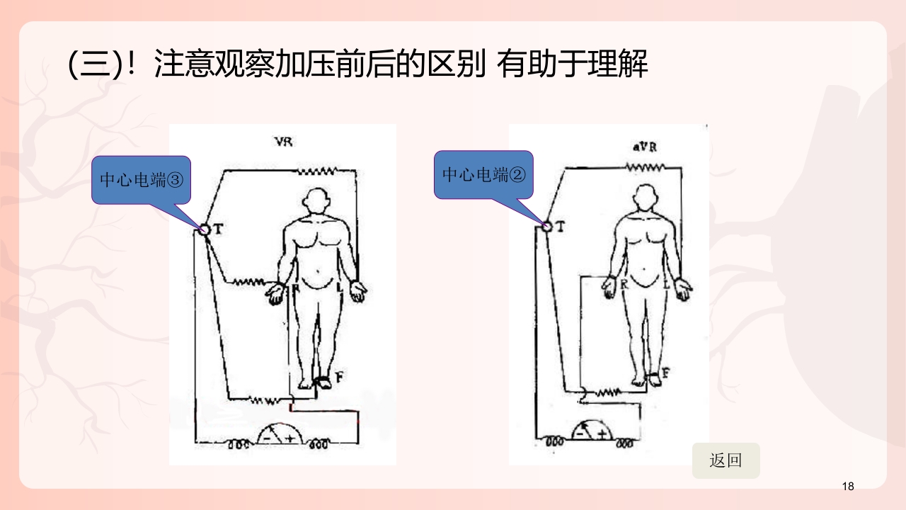 心电图机的正确使用PPT课件下载19