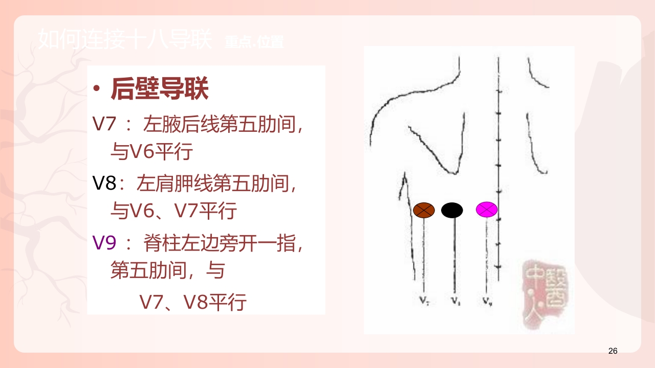 心电图机的正确使用PPT课件下载27