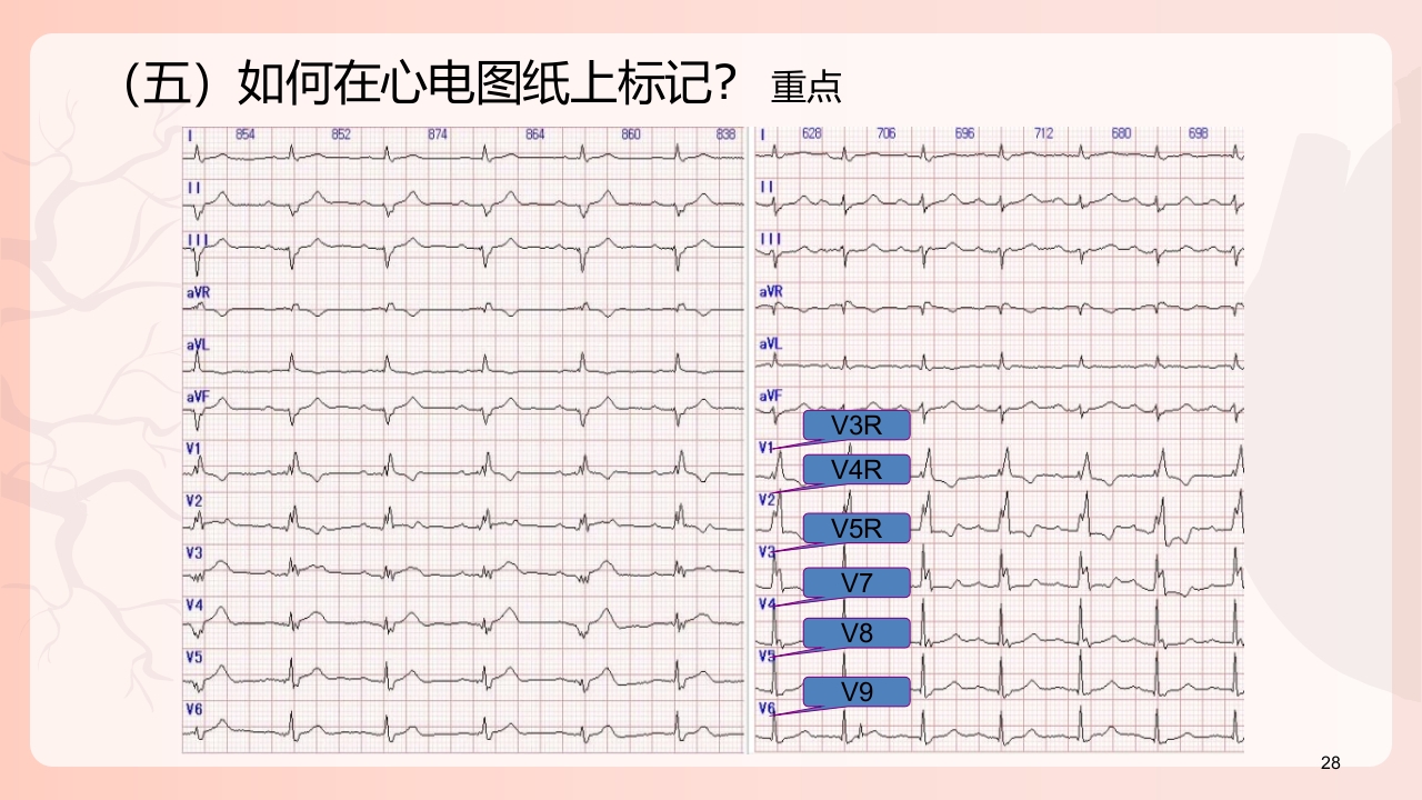 心电图机的正确使用PPT课件下载29
