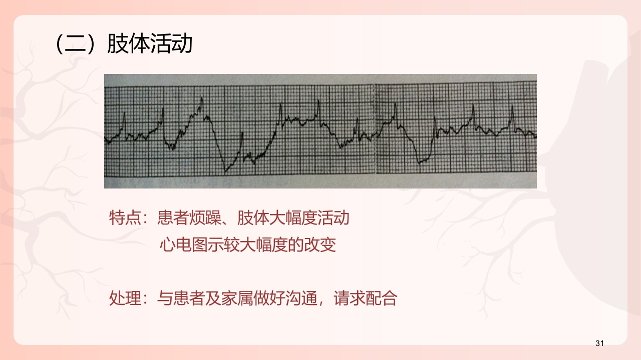 心电图机的正确使用PPT课件下载32
